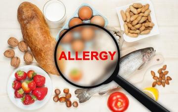 ¿Qué es importante saber sobre las alergias alimentarias?