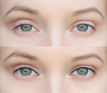 Método de aplicación de máscara para hacer que los ojos se vean más jóvenes (mostrando en el modelo 30+)